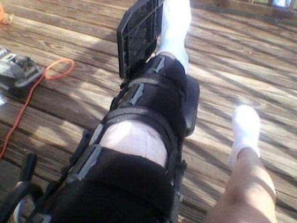 Knee Pain Treatment – All About The Importance Of Knee Braces